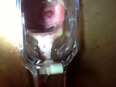 look inside her snatch trough speculum