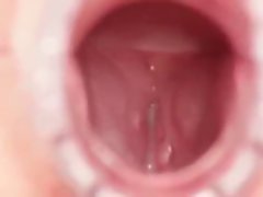 Vaginal Secretion