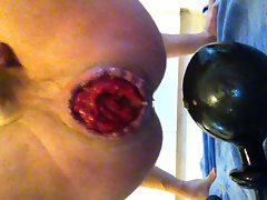 Huge prolapse fuck