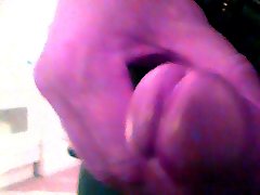 my foreskin