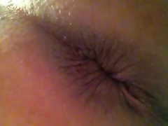 mybutthole1