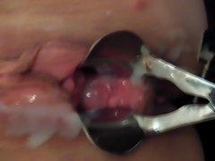 Speculum Creampie