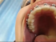 Braced woman's mouth tour