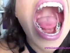 Metal mouth